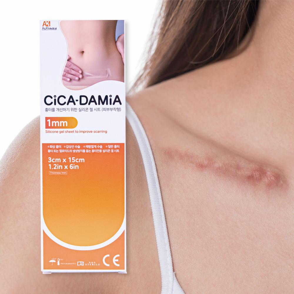 시카다미아 제왕절개 흉터 밴드 화상 수술 시카케어 실리콘 겔 시트 밴드 3cmx15cm