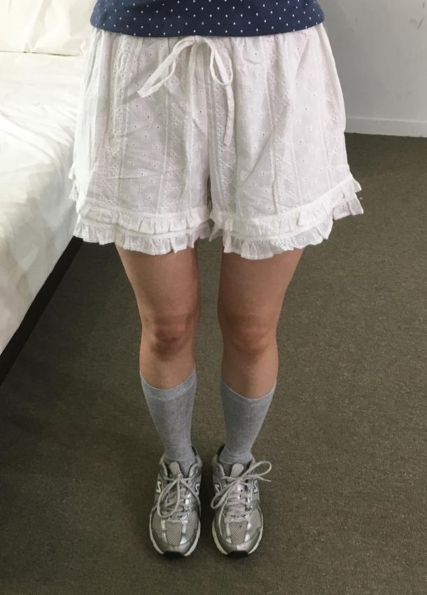 오브그린 [-3kg/안감] 니드 펀칭 프릴 하프 팬츠 (1color)