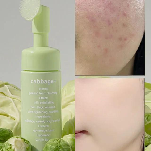 묵은각질+피지 순삭템 저자극필링 얼굴각질 블랙헤드 제거 필링폼클렌징 150ml