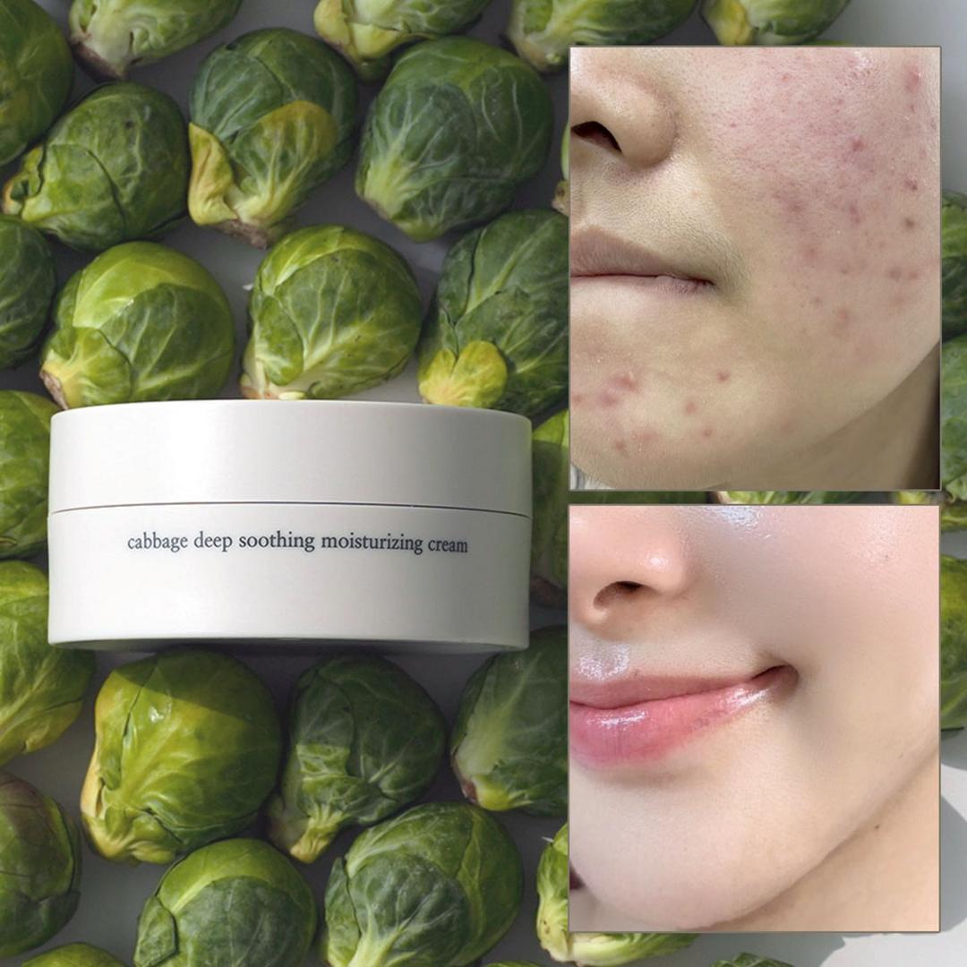 [대용량] 엘리메르 캐비지 딥 수딩 시카 수분크림, 150ml, 1개 - 페이셜크림 | 쿠팡