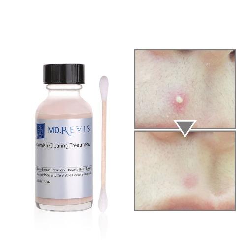 [자동압출 핑크스팟]블레미쉬 클리어링 트리트먼트 30ml 흉없이 모낭충 OUT (109천에서 1만 인하)