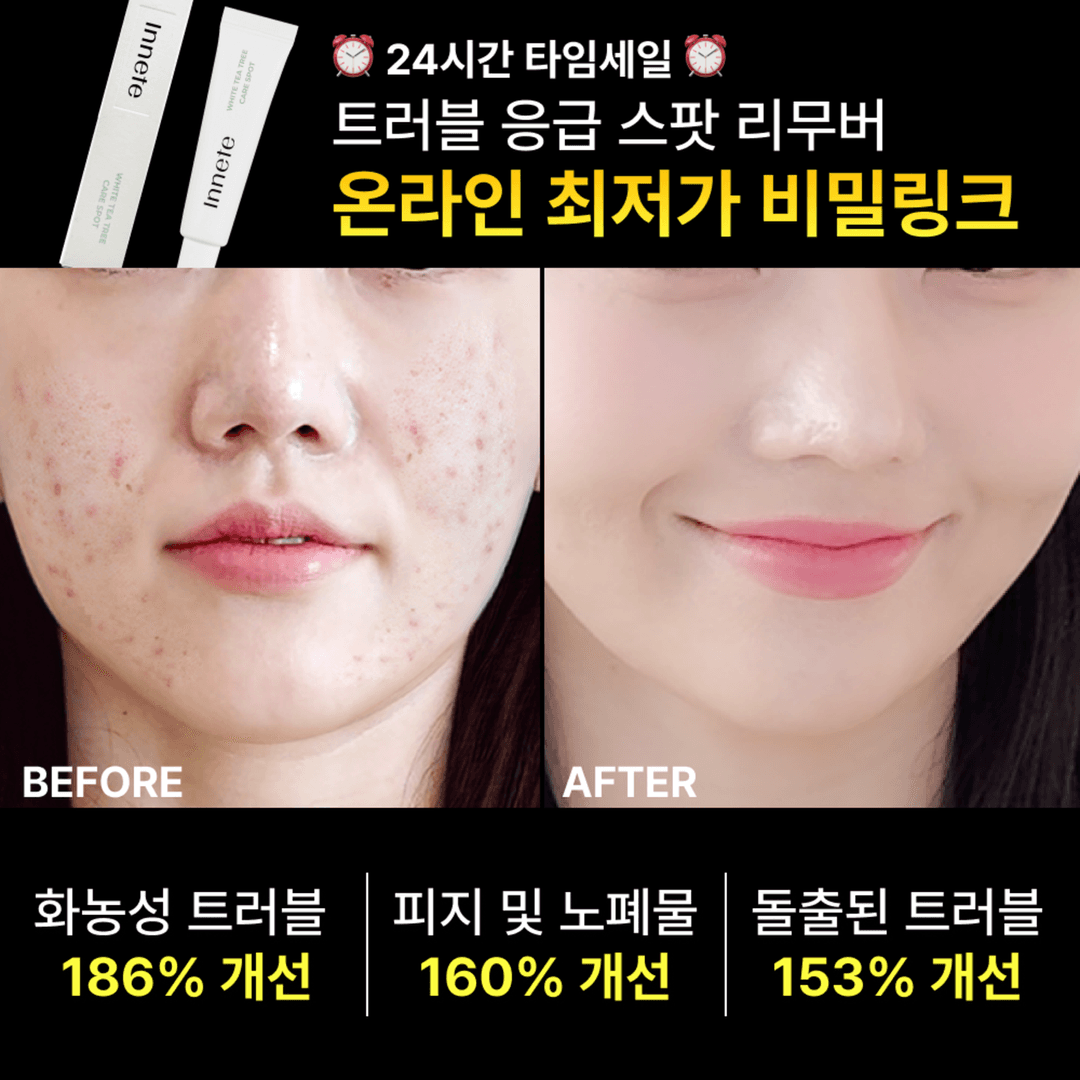 💸24시간 타임세일💸  응급 스팟 리무버 비밀특가