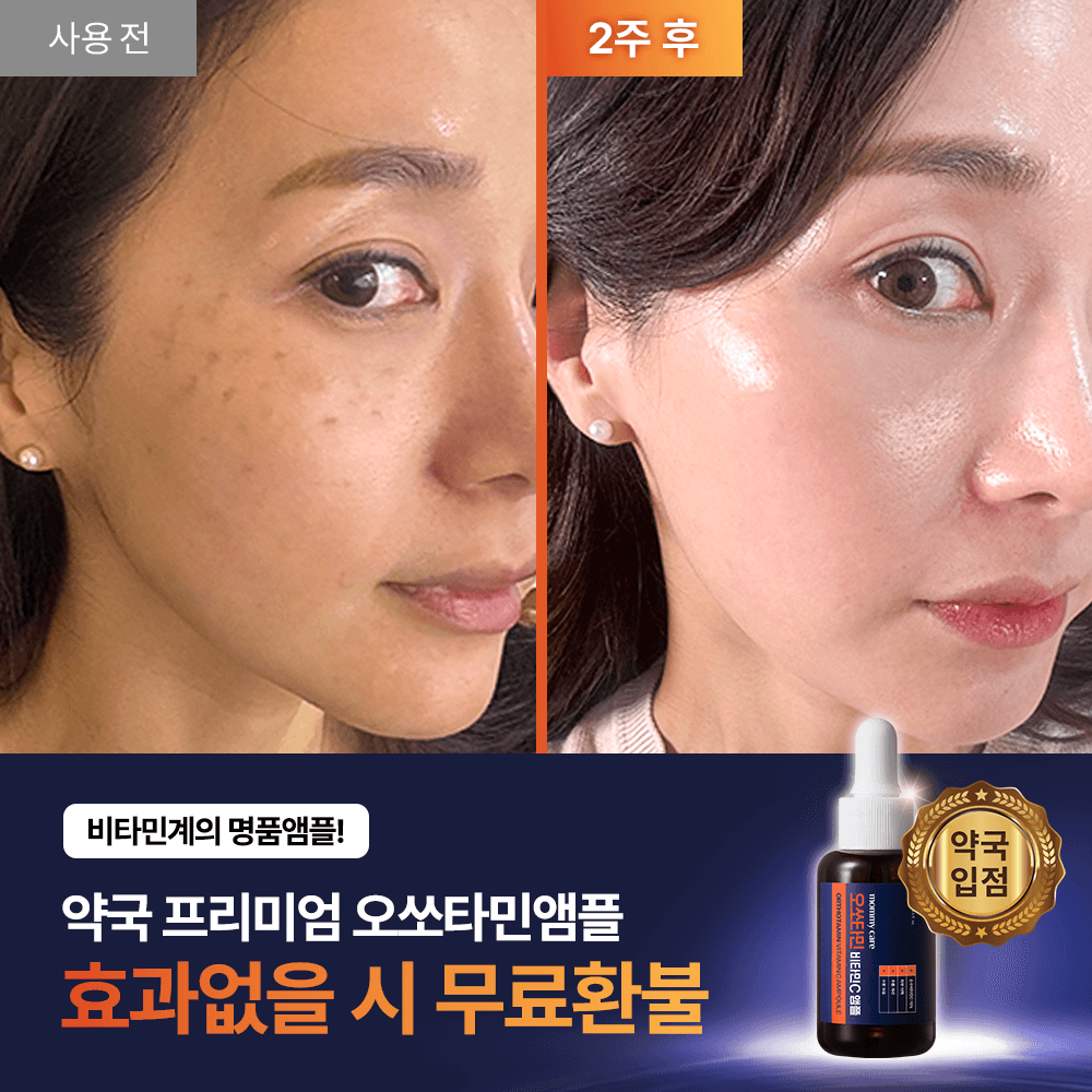 [최저가 보장] 프리미엄 오쏘타민 앰플 마켓 특가