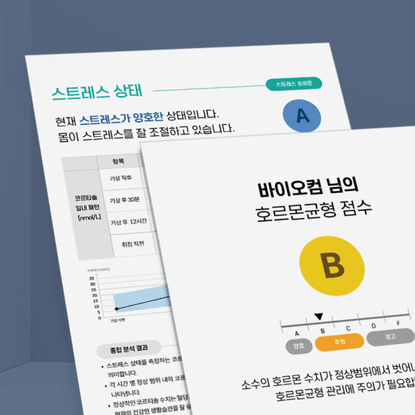 스트레스 노화 분석