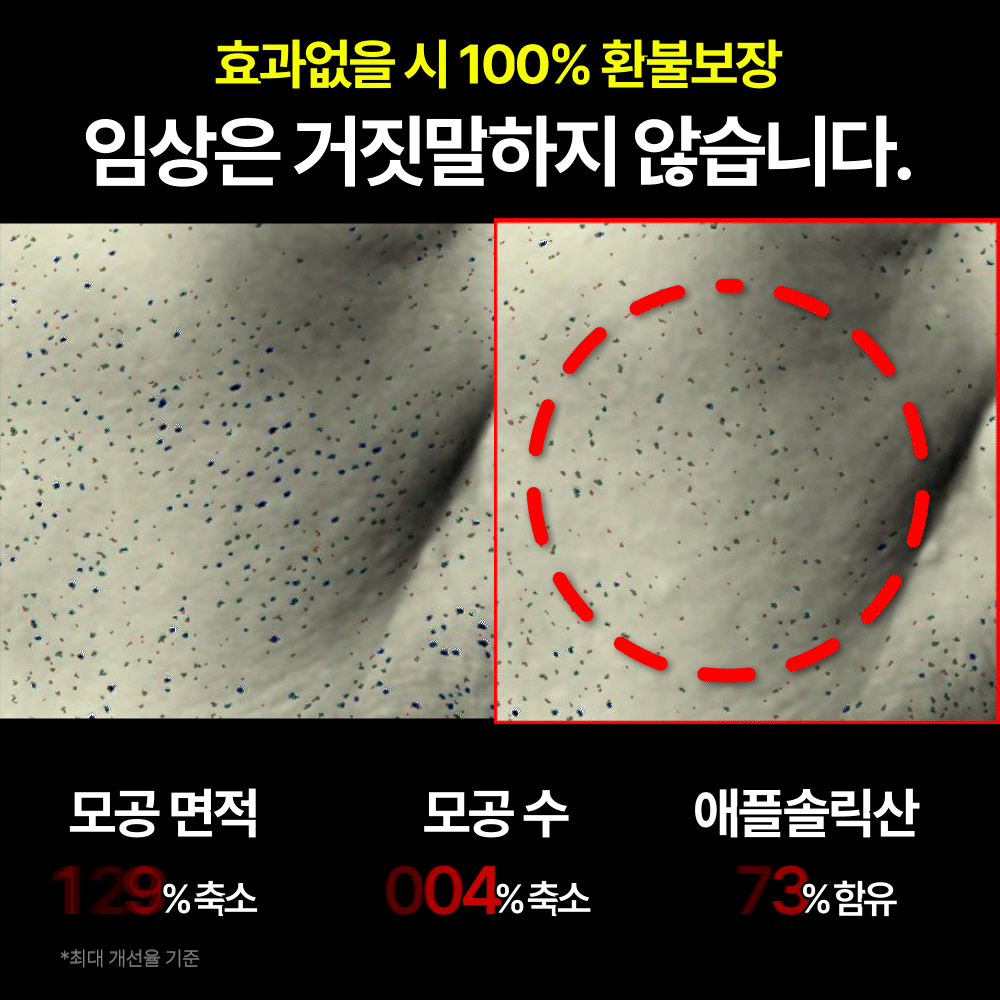 2시간 뒤 가격상승🔥 모공축소 성분만 72% 핑크사과 모공앰플 비밀특가