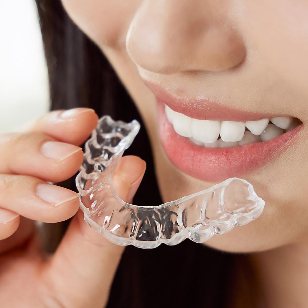 이갈이마우스피스 라이트 단품 수면용 스플린트 이갈이방지