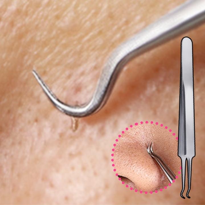 [미친효과를 누리세요] 기적의 쥐젖패치