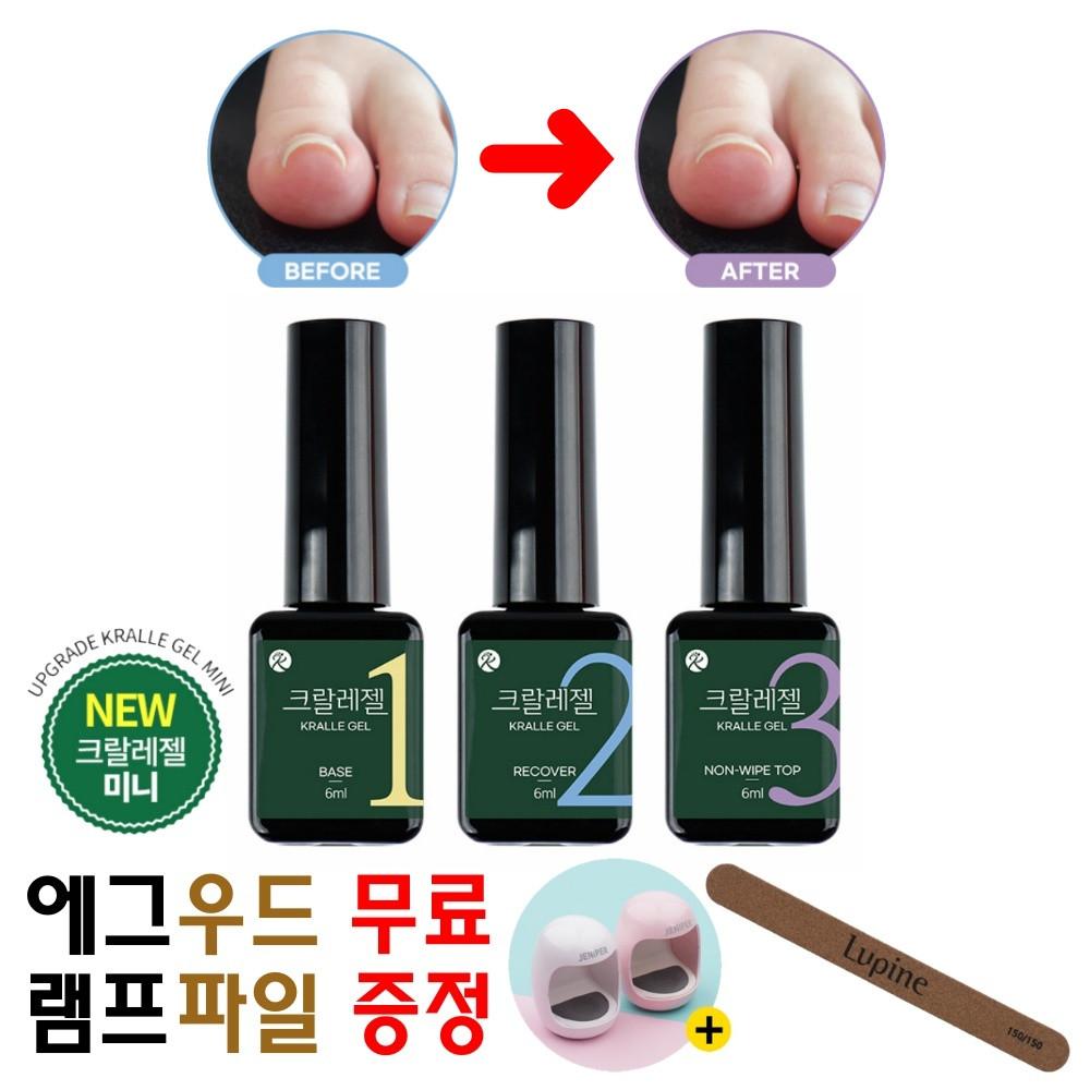 문제성발톱 업젤 파고드는 발톱 케어세트 닥터크랄레젤 에그램프 우드파일