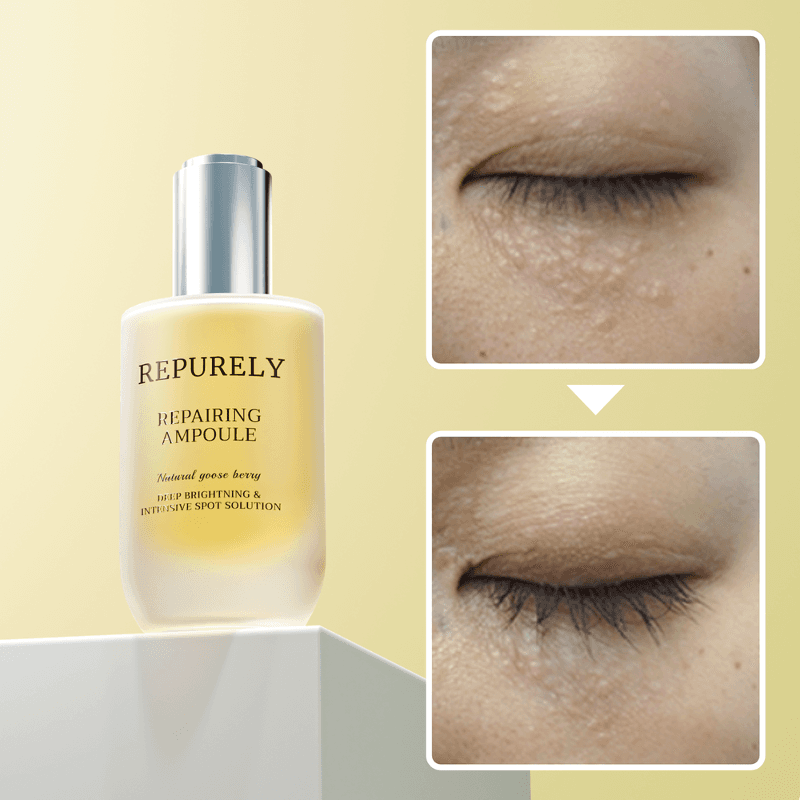 리퓨어리 악티타온 앰플