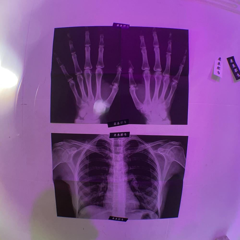 엑스레이 포스터