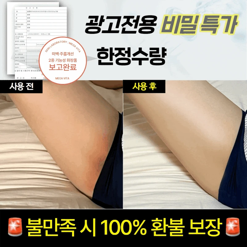 [🔒비밀링크 특가] 엘롭 메가비타 B3 라이트업 시크릿 리터닝 크림