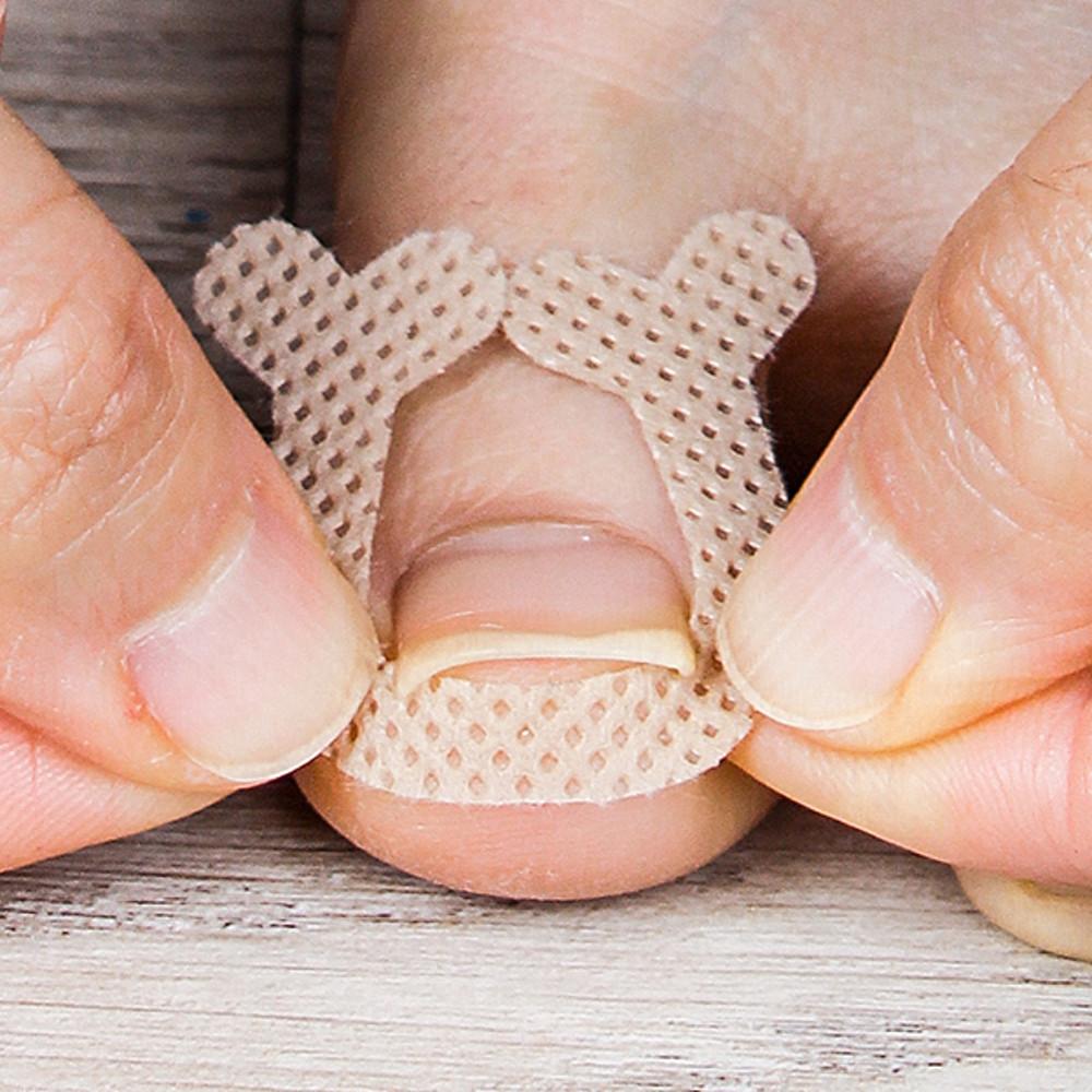 핀처 프로밴드 내성발톱 테이프 52개입 / 케어 교정