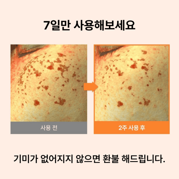 비시나크림 속기미 전문 전용 크림 50ml