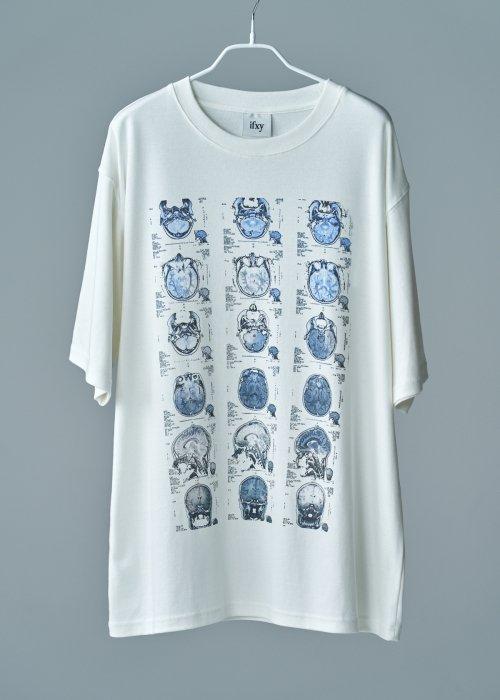 Blue in my head [T10W]