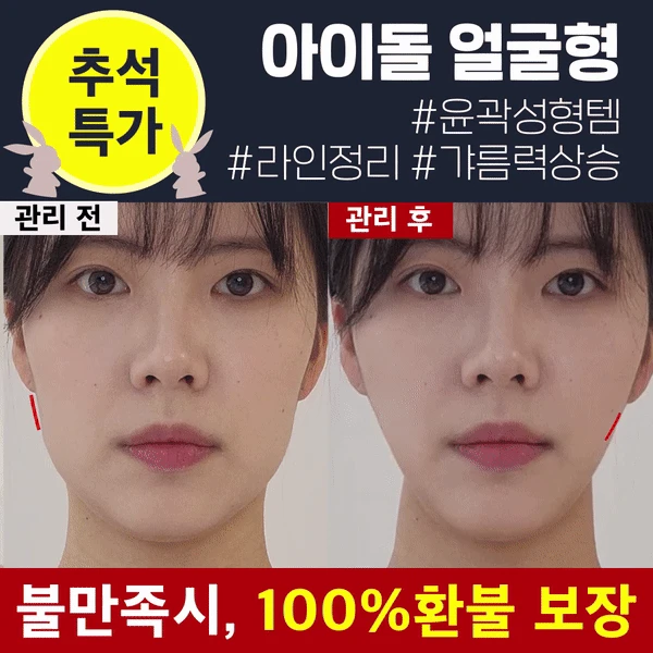 [🔒추석특가 비밀링크] 청담샵 뷰티 디바이스 EMS 브이쎄라 선착순 특가!