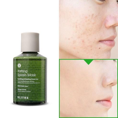 블라이드 패팅 스플래쉬 마스크 수딩 앤 힐링 그린티, 1개, 1개 - 클렌징 | 쿠팡