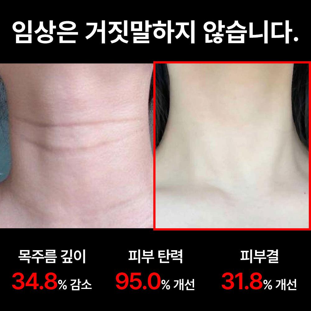 [🔒비밀링크] 나노 스텝™ 콜라겐 넥마스크 1+1