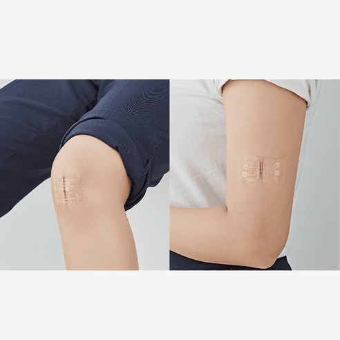 서지너스 응급 상처봉합 풀밴드 봉합키트, 풀밴드 봉합키트 0..., 1개 - 약통/구급함 | 쿠팡