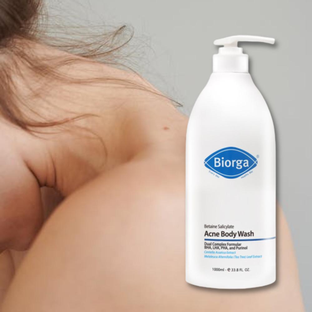 바이오가 베타인살리실레이트 바디워시 올인원 등드름 약산성 1000ml