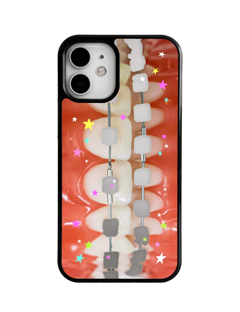 Twinkle teeth mirror case (미러 범퍼)