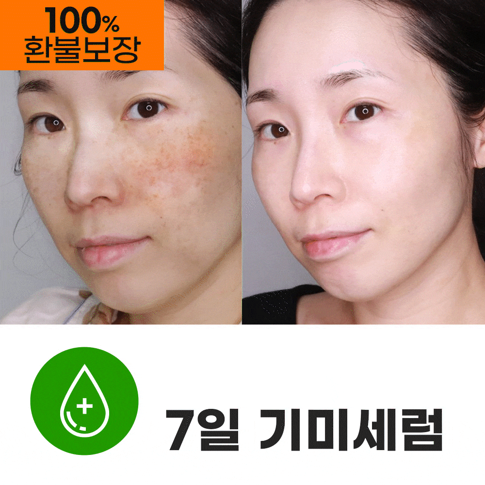 🔥2시간 단독특가 9900원🔥임상입증 #7일기미세럼