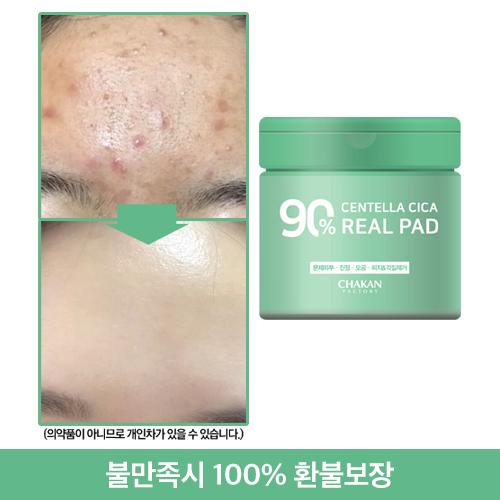 문제피부 모공 진정 각질 피지 센텔라시카 90% 리얼 토너패드