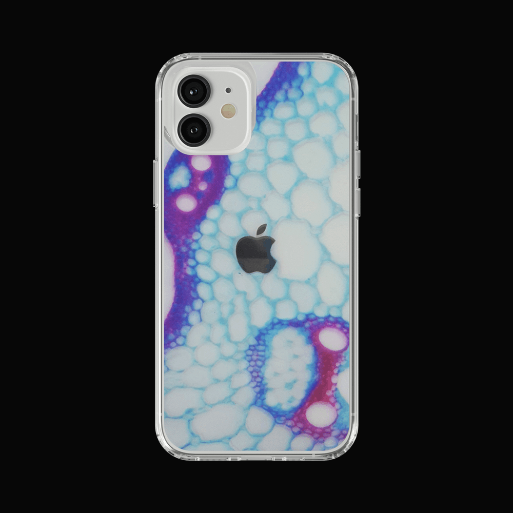 Plant Stem 반투명 젤하드 폰케이스