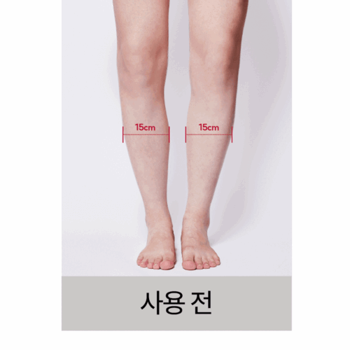 슬리미오 종아리알제거 아치 깔창