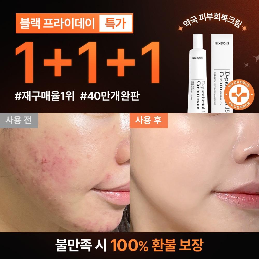 ♥단 하루만!♥ 1+1+1만원 선착순 특별 할인 한정 수량 7일 피부회복 크림