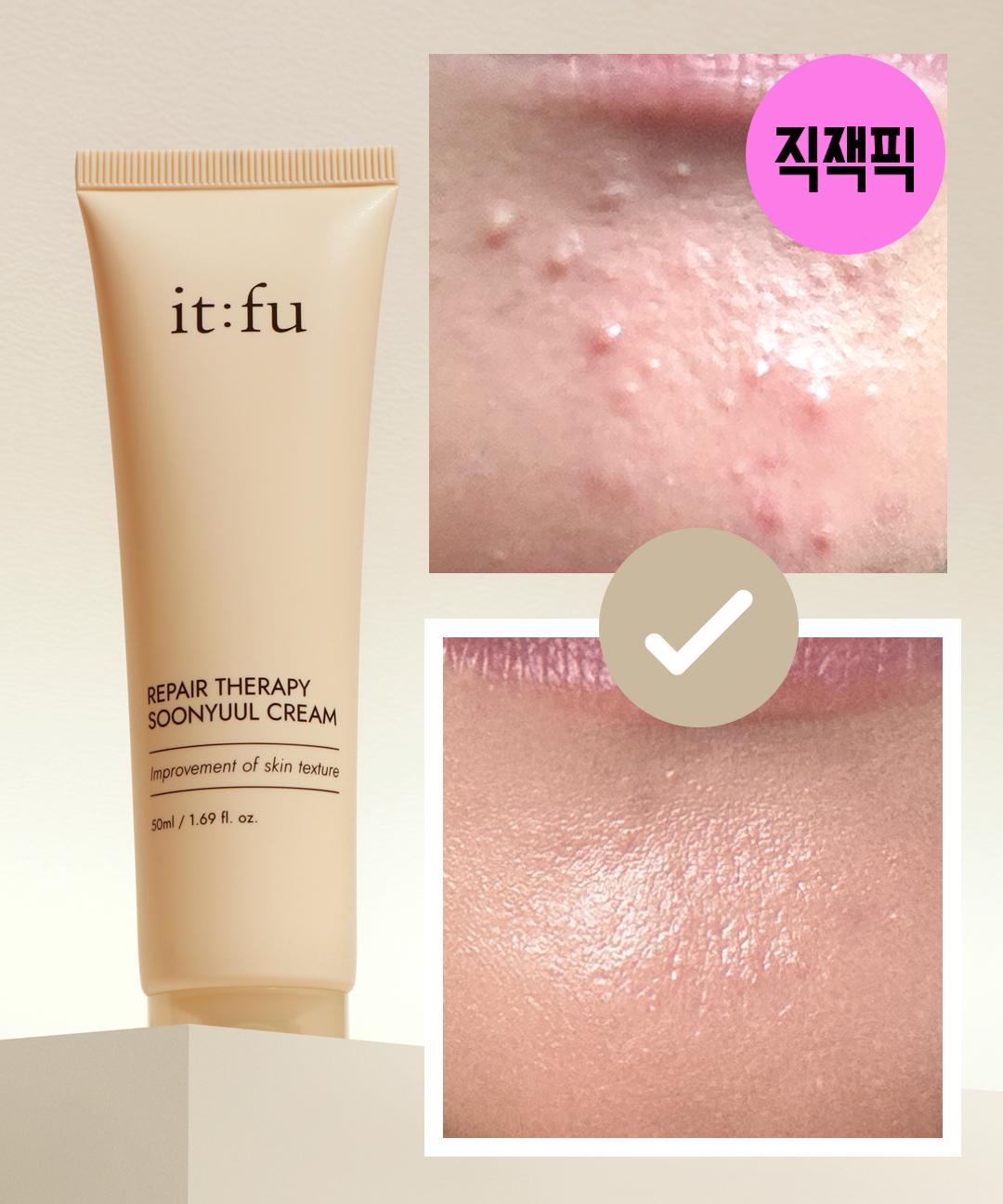 잇퓨 🏆요철&좁쌀 케어 부분🥇 리페어 테라피 순율 크림