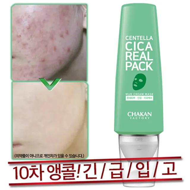 모공 팩 여드름 클레이팩 머드팩 워시오프 센텔라 시카