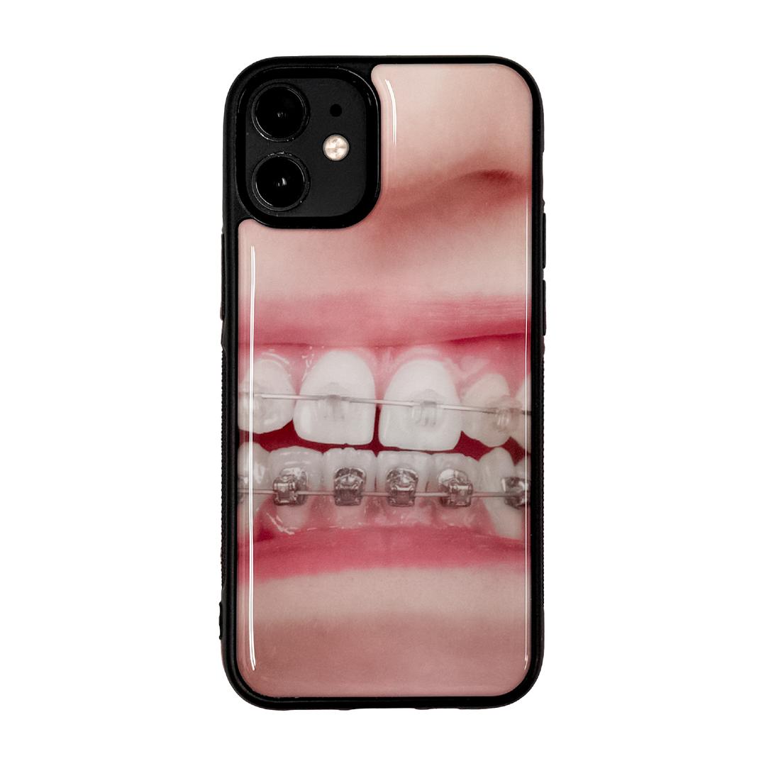 <Duitproejct>  Teeth Epoxy Case