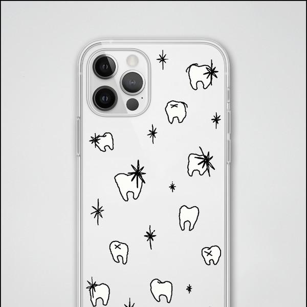 충치 클럽 패턴 케이스