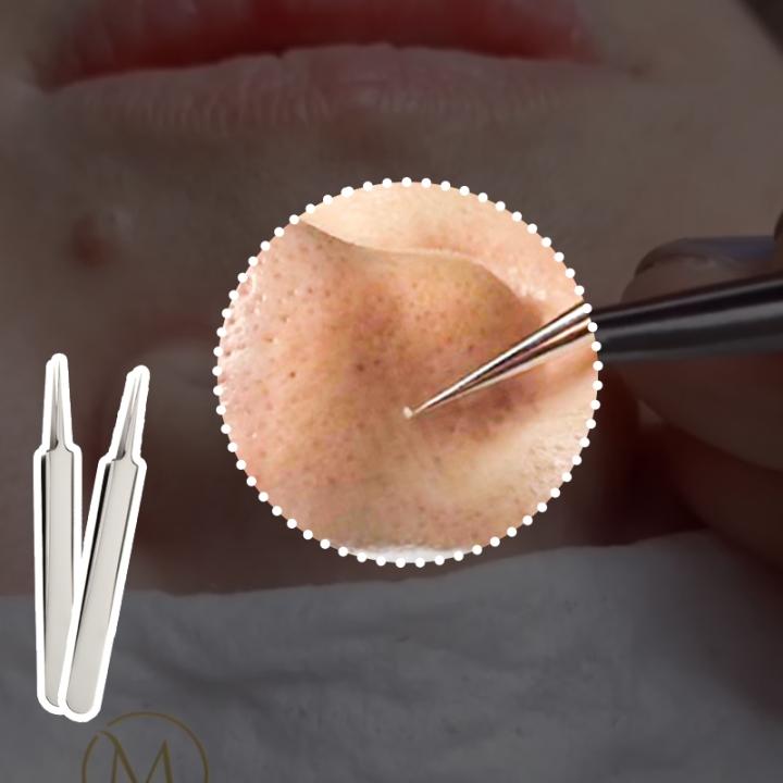 피부관리실 전용템 피지핀셋