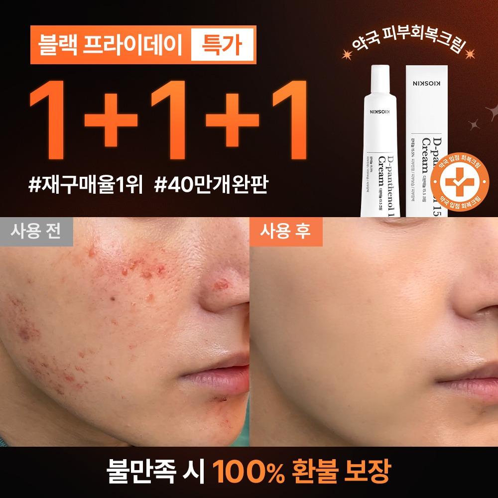 ♥단 하루만!♥ 1+1+1만원 선착순 특별 할인 한정 수량 7일 피부회복 크림