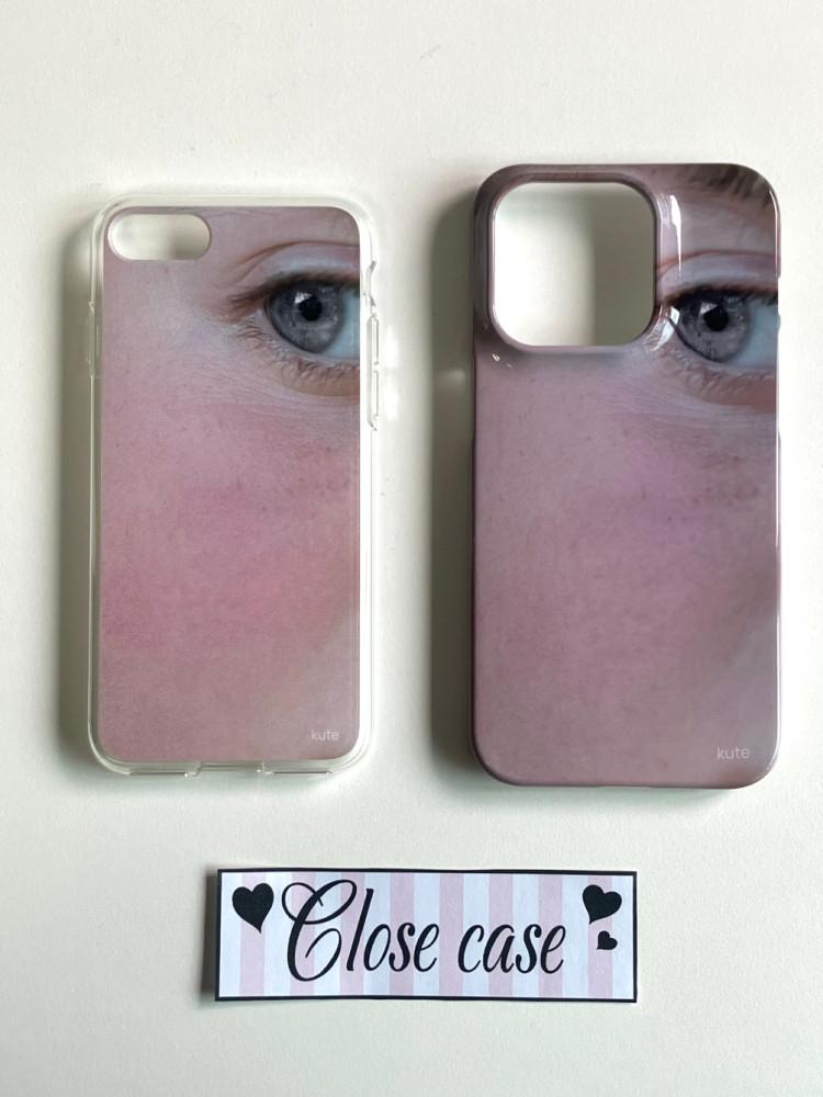 [Cheek series] Close case