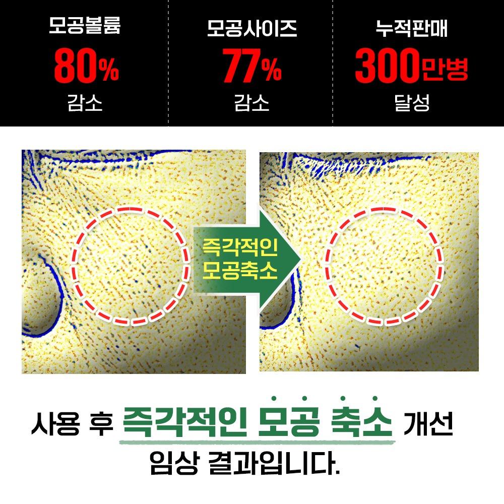 💸2시간 뒤 가격 약 4배 상승💸 모공앰플 9,900원!