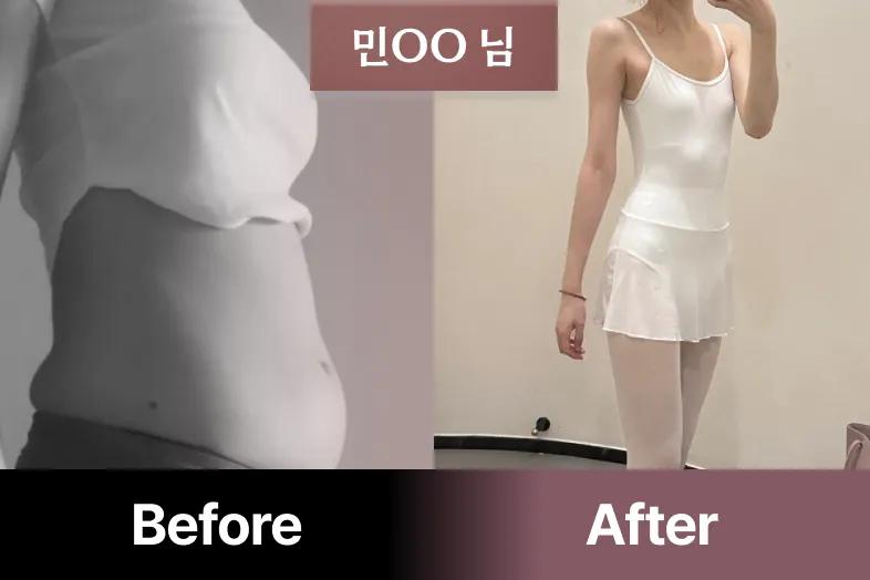 ※목표 달성 시 100% 환급※여신핏과 곧은 자세를 한 방에 [예핏홈발레] | 배움을 재밌게, 탈잉!