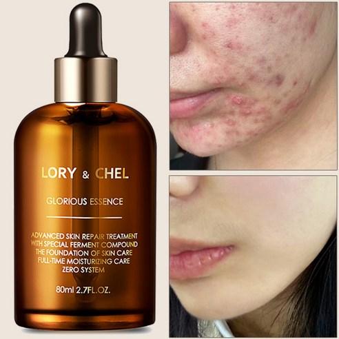 로리앤첼 글로리어스 에센스 앰플 세럼 80g, 80g, 1개
