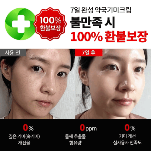 100% 환불보장🎁 [강남약국크림] 들깨기미크림 선착순 100명!