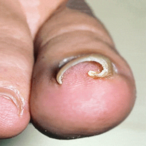 핀처 발톱 프로밴드 내성 강한 테이프 PT-V3