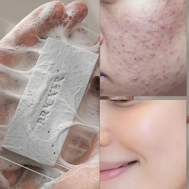 여드름 벽돌비누🧱 좁쌀케어 트러블케어 어성초 고농축 진액이 늘어나는 숙성 클렌징 머드팩 CP 클렌징솝 140g