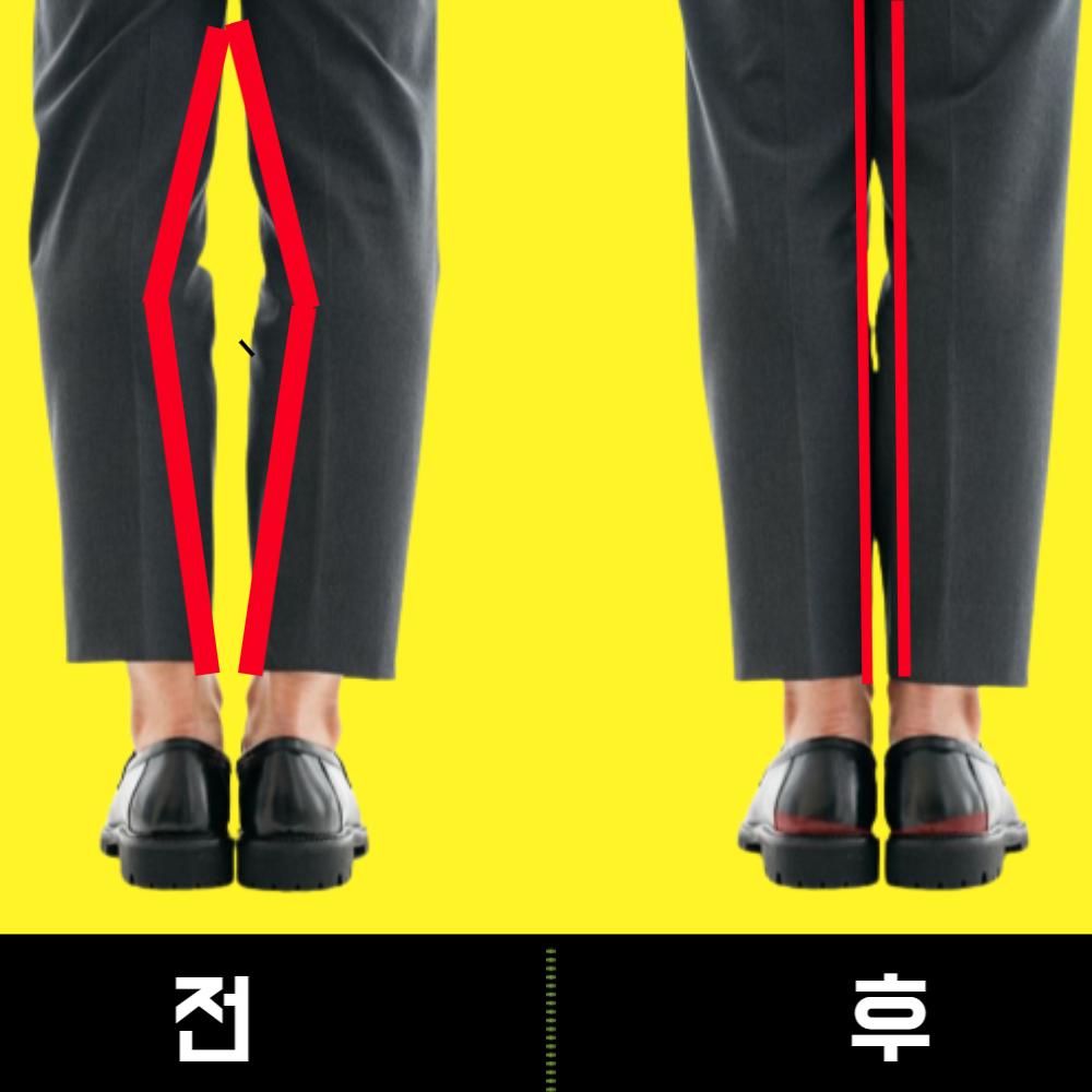 [2세트] 오다리깔창 팔자걸음 안짱다리 걸음걸이 교정 깔창 [구도풋]