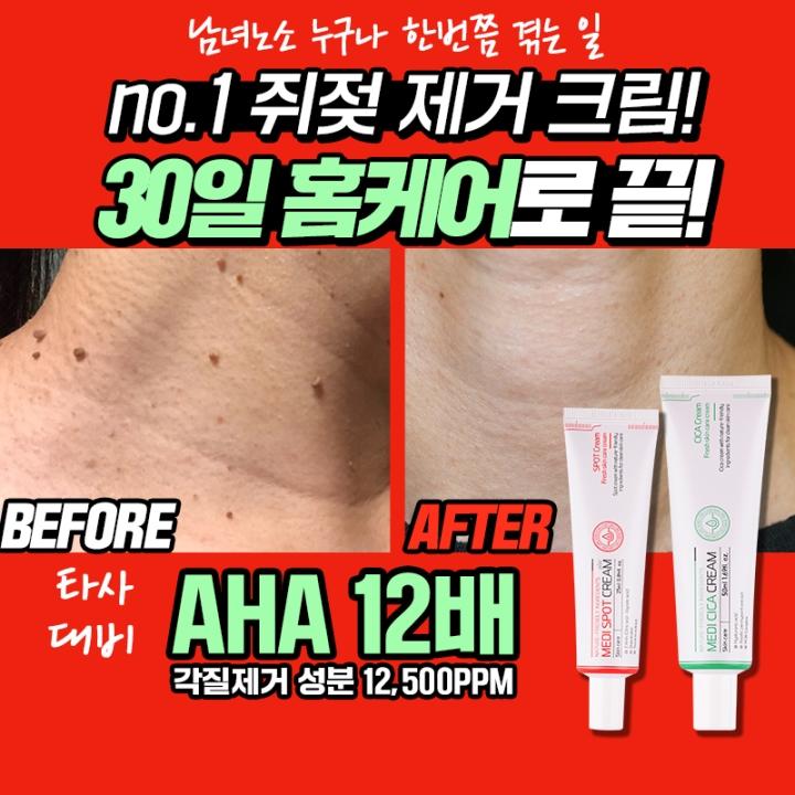 쥐젖제거크림 비립종 편평사마귀 작심랩 메디스팟크림 플러스 아하성분12배