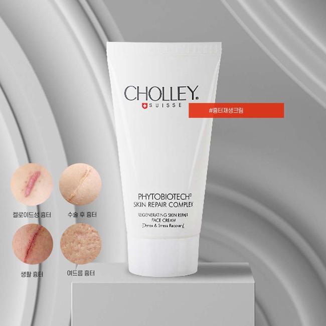 [66% event!!] 숄리 흉터재생크림(파이토바이오텍 스킨 리페어 컴플렉스) 150ml