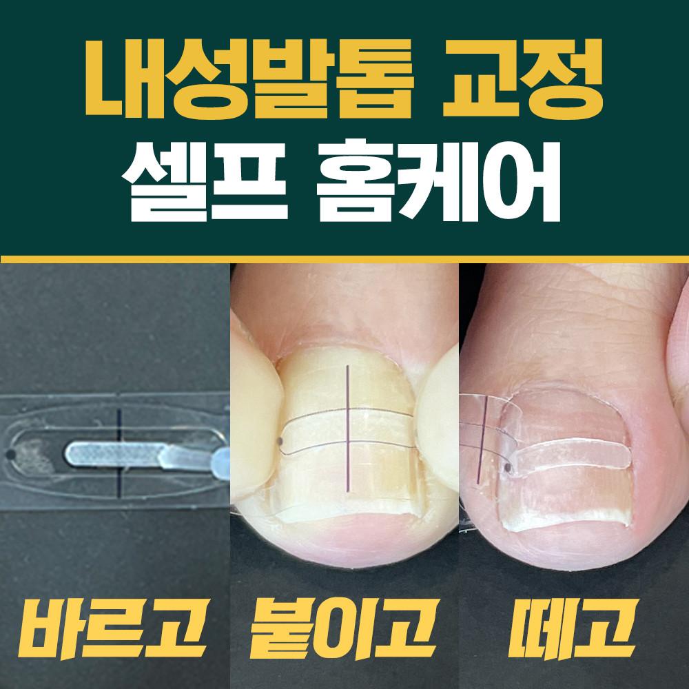 퍼펙토 내성 발톱 교정 스트립