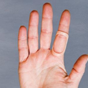 오벌-8 (Oval-8 Finger Splints)